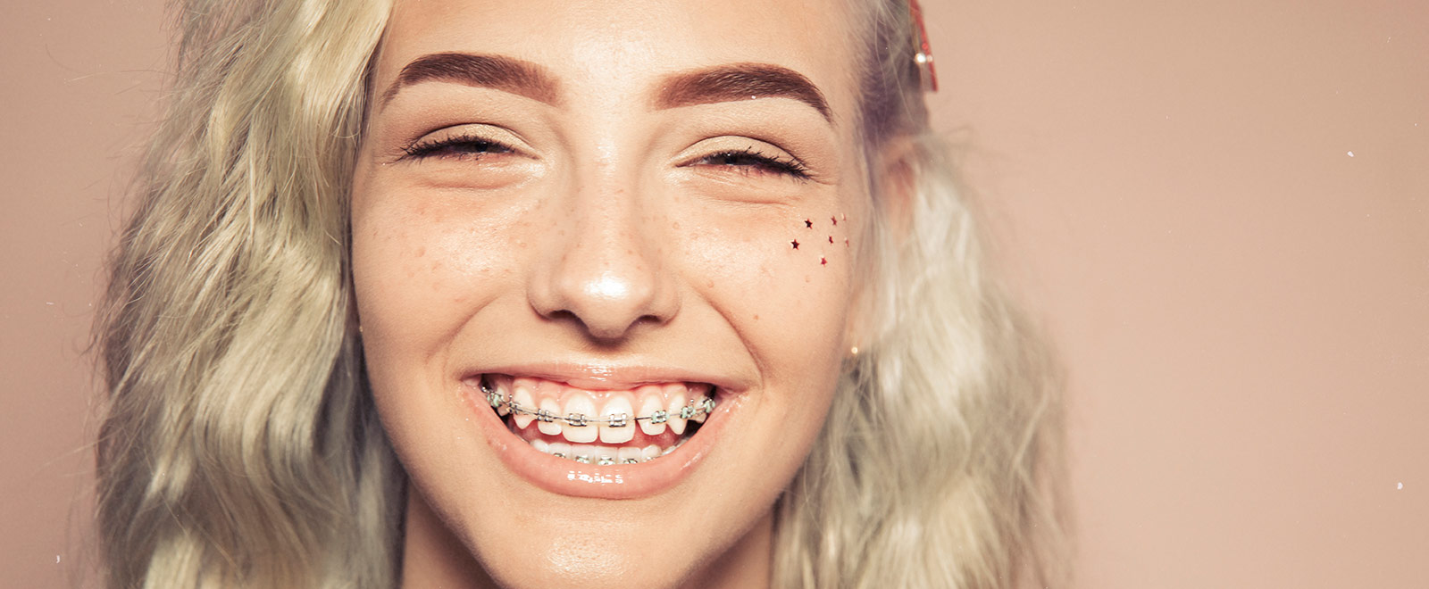 teenager with braces smiling for the camera