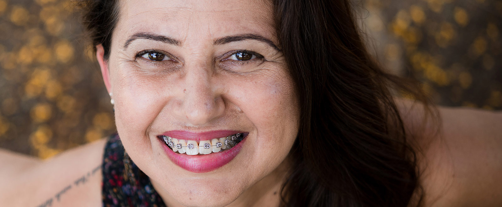 adult with braces smiling for the camera